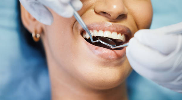 Best Emergency Dentist for Lost Fillings or Crowns in Mary Esther, FL